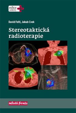 Stereotaktická radioterapie | David Feltl, Jakub Cvek