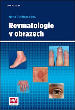 Revmatologie v obrazech | Marta Olejárová
