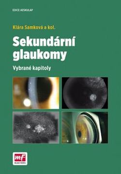 Sekundární glaukomy | Klára Samková