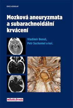 Mozková aneurysmata a subarachnoidální krvácení | Vladimír Beneš